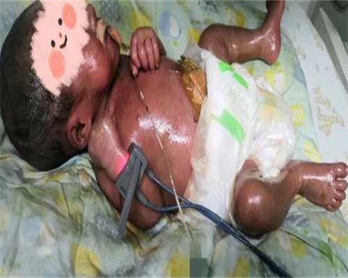 试管三代促排卵移植多少钱(三代试管婴儿促排卵)