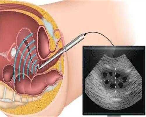 肇庆专业试管助孕机构有几家,医院排名看哪些？
