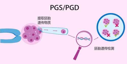 助孕包儿子费用,[家庭的港湾]子宫腺肌症能试管婴儿吗
