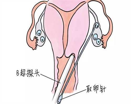 为什么专业代怀孕医院要求囊胚移植呢，求收费价目表！