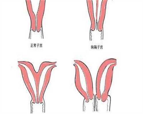 外国试管婴儿多少钱_山大生殖在全国排名,试管婴儿移植后便秘影响着床吗(试
