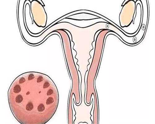 现在试管婴儿成功率高