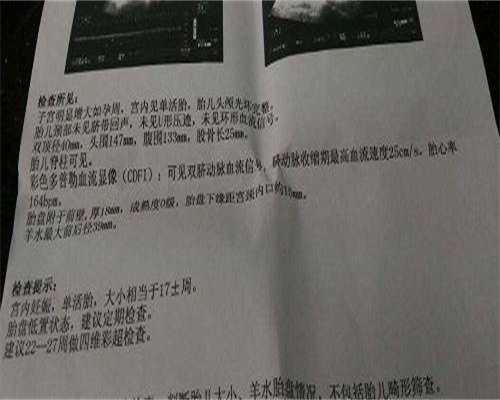 常德试管三代成功率高的医院比较有名的是哪些，让你选择不再迷茫