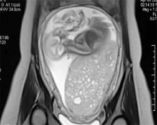 试管婴儿多少钱哈尔滨？