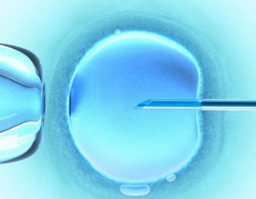 包成功代孕哪家靠谱,多囊卵巢综合征患者能正常受孕吗,经过治疗后有一定可