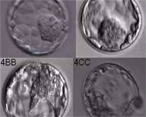 单身女性日本试管婴儿借卵机构医院哪家强(日本做试管婴儿借卵机构多少钱)