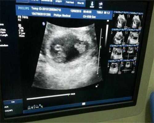 河北三代试管比较好的医院排名前十,成功率有多少