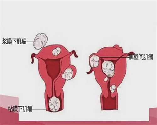 哈尔滨试管排名前十名的医院,哪些医院上榜了