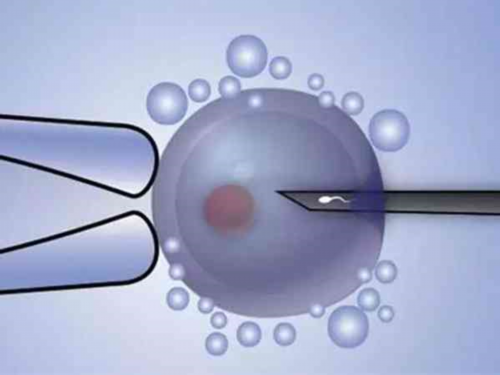 哈尔滨第三代试管婴儿生男孩价格多少！如何节省试管费用？