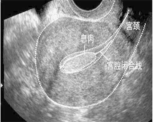 三代代生机构咨询三代代生机构咨询费用明细是怎样的？(三代代生机构咨询三