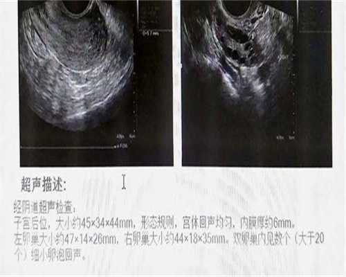 去新疆佳音医院做一代代生儿子在线咨询,大概需要带多少钱?