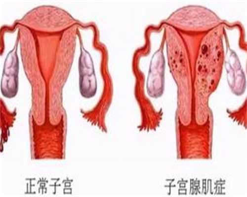试管3代需要多少钱一次_试管婴儿3代多少钱一次
