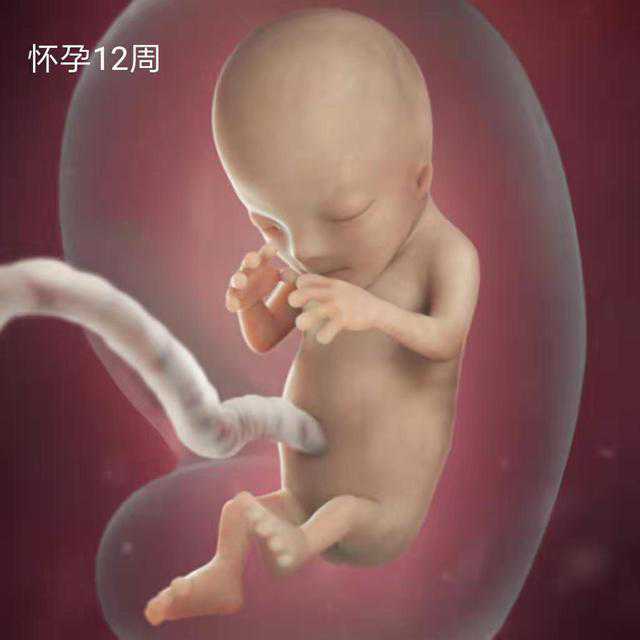 妊娠3个月胎儿发育快报：男女差别初见端倪,NT图大有文章.jpeg